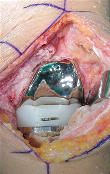 Figure3