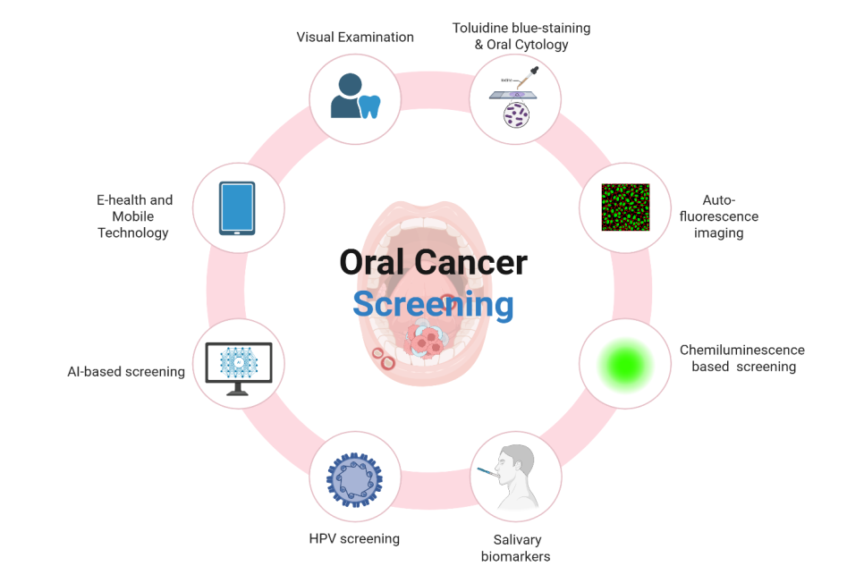 Figure 5. Methods for Oral Cancer Screening : Oral Cancer Screening and ...