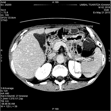 Figure2