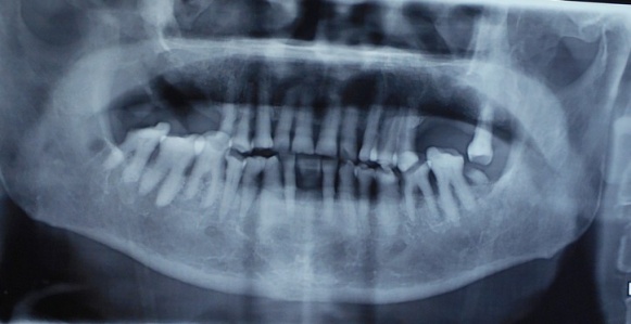 Figure3